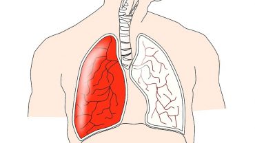 triệu chứng thường gặp ở khoa nội hô hấp